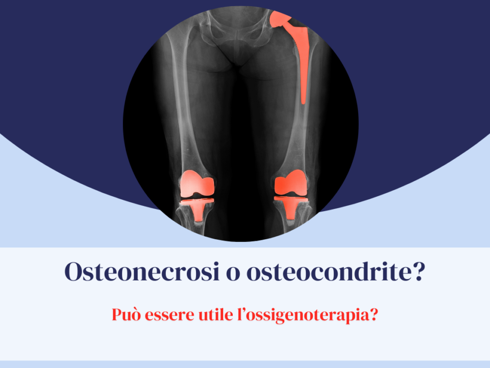 Osteonecrosi o osteocondrite?