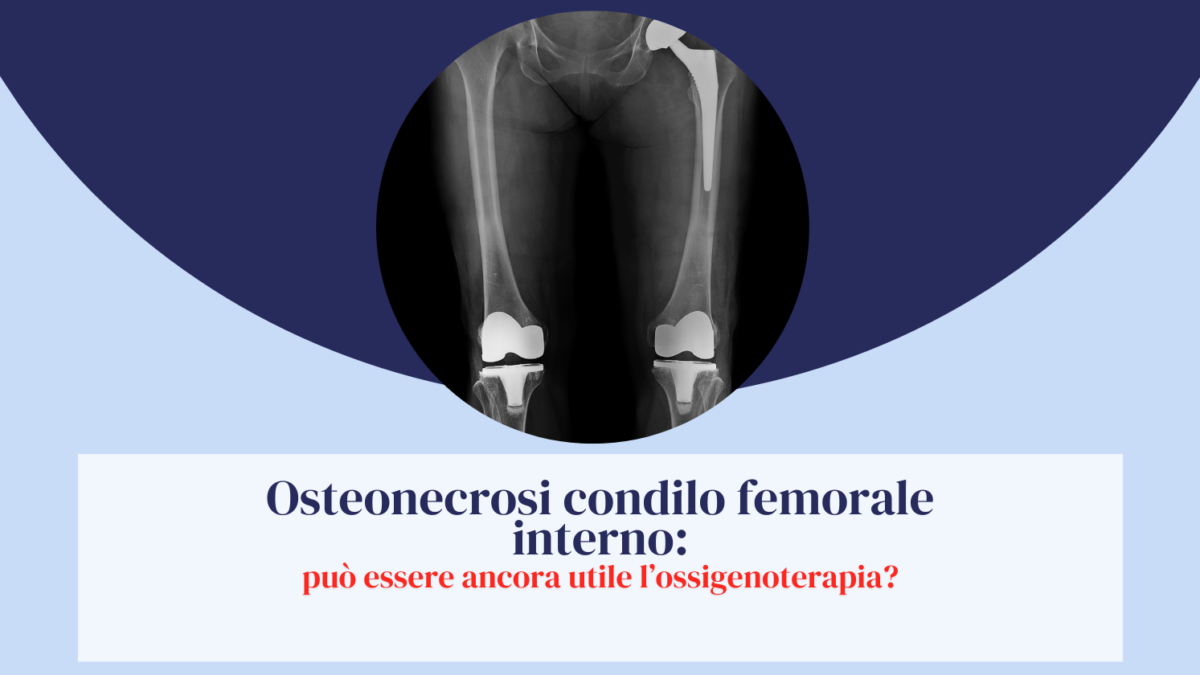 Osteonecrosi condilo femorale interno