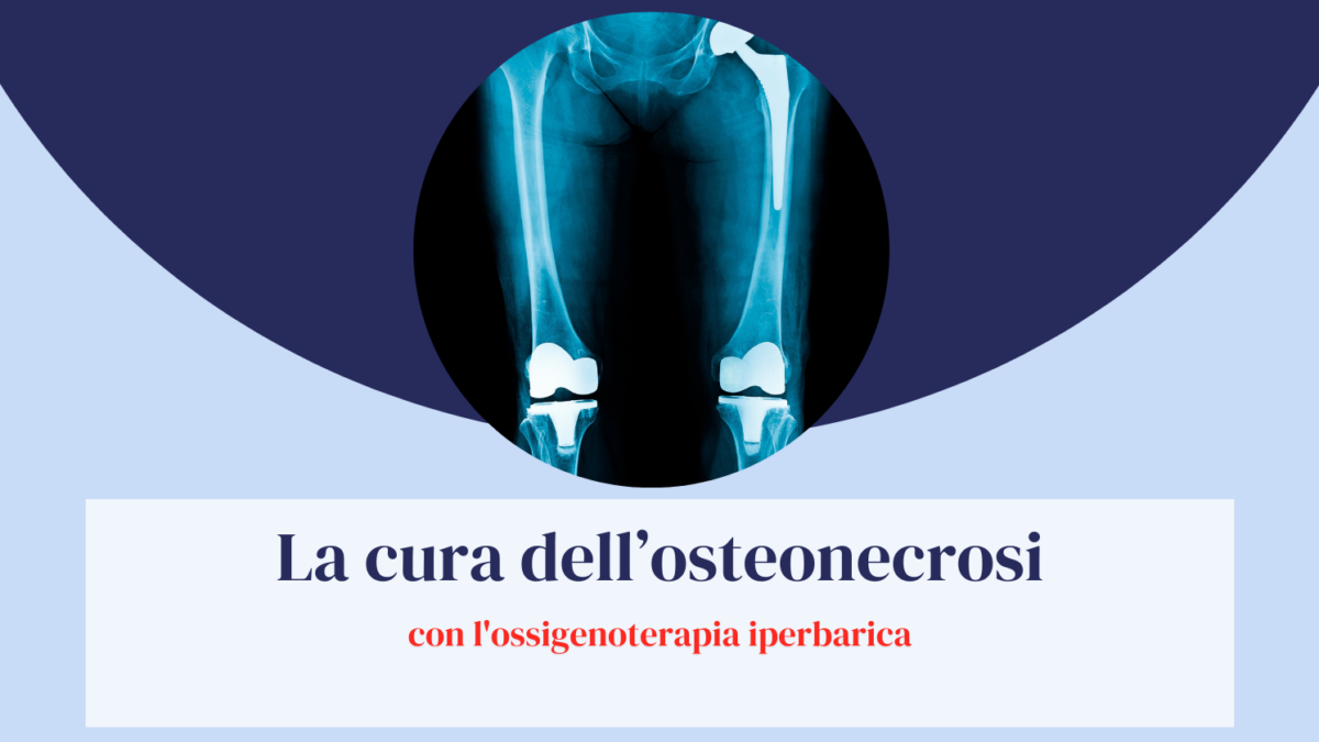 cura osteonecrosi OTI