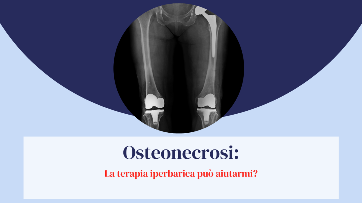 osteonecrosi
